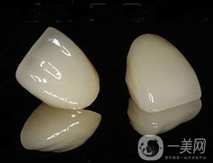貴金屬烤瓷牙的危害有哪些？