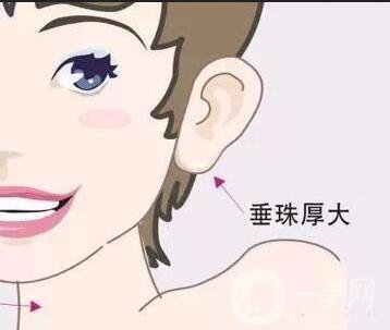 玻尿酸豐耳垂好嗎 相學(xué)解析有耳垂才有福氣