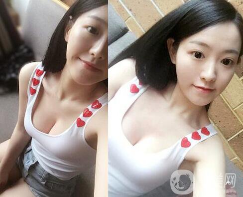 假體隆胸有什么危害？