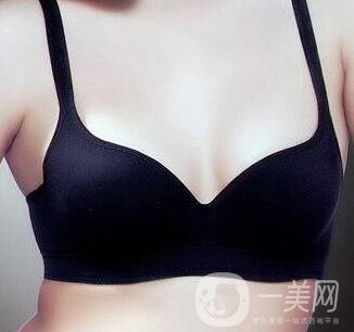 副乳切除術(shù)創(chuàng)口多大？