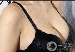 假體隆胸手術(shù)做完之后恢復(fù)期要多久時(shí)間？
