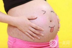 有妊娠紋怎么辦？什么方法**？