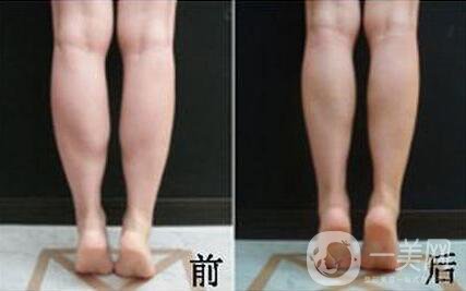 *的副作用有哪些？