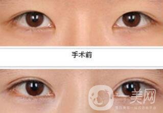 *都包含哪些項目？*整形多少錢