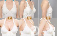 自體隆胸后多久可以上班？術(shù)后有哪些注意事項(xiàng)