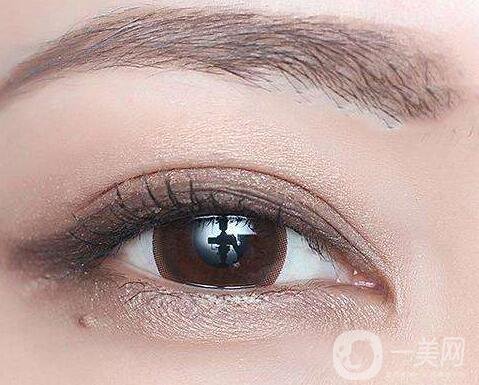 割雙眼皮術(shù)后注意事項(xiàng)有哪些？