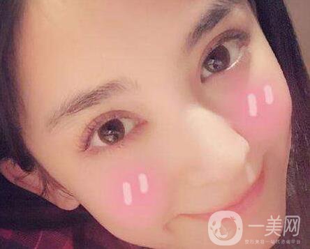 做了雙眼皮增生怎么辦？