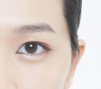 什么人適合開眼角？開眼角適宜人群有哪些？