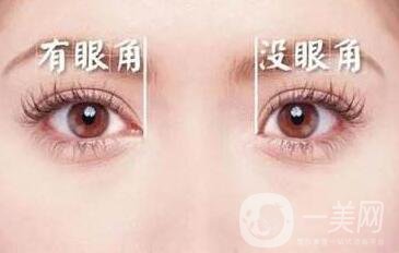 北京,開眼角