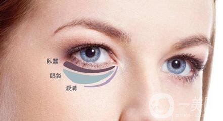 內(nèi)切祛眼袋術(shù)后護(hù)理主要有哪幾點(diǎn)？