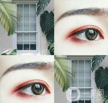埋線雙眼皮要拆線嗎？如何護理？