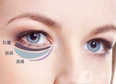 內(nèi)切眼袋真實(shí)恢復(fù)過程，術(shù)后注意事項(xiàng)