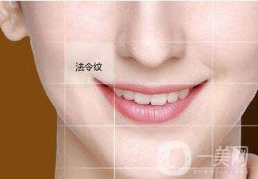 自體脂肪豐鼻唇溝,*果,術(shù)后護理