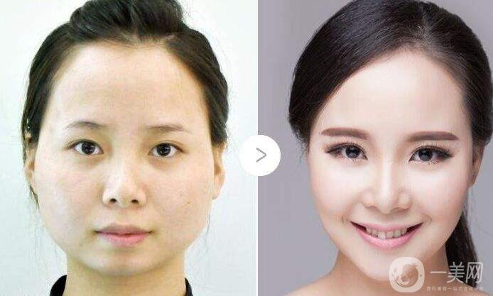 打*,多少錢
