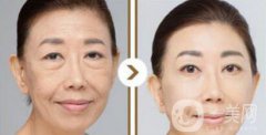 塑美極果怎么樣？塑美極的副作用