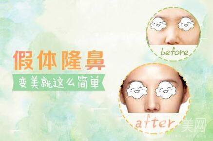 硅膠隆鼻可以維持一生嗎？