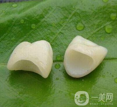 金鈀合金烤瓷牙價格多少錢？