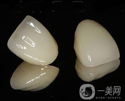 鈀銀合金烤瓷牙危害有哪些？