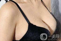 北京妙姚假體隆胸需要多少錢(qián)?
