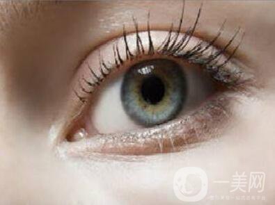 開內(nèi)眼角術后護理注意事項