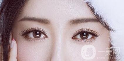 全切雙眼皮多久恢復(fù)？