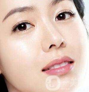 開內(nèi)眼角多久恢復自然？