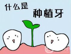 人工種植牙做一顆價格