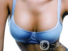 硅膠隆胸能管多久？隆胸手術(shù)具體費(fèi)用