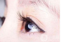 開(kāi)眼角增生怎么修復(fù) 修復(fù)費(fèi)用是多少