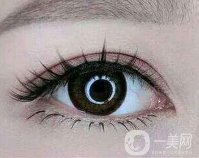 雙眼皮埋線(xiàn)前注意什么？