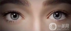 武漢割雙眼皮需要多少錢?