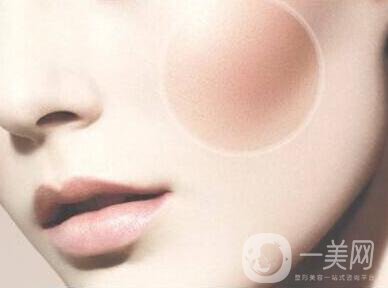 顴骨手術(shù)多長時(shí)間恢復(fù)？
