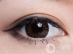 上海開眼角手術(shù)的費(fèi)用是多少？