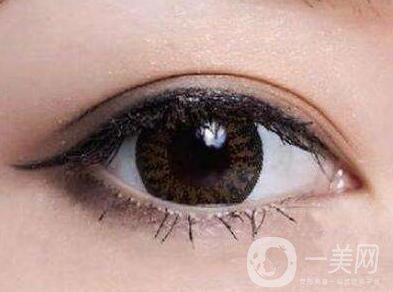 上海開眼角手術(shù)的費用是多少？