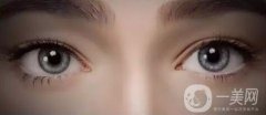 開眼角手術(shù)價格是多少？