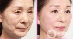 冰點拉皮果怎么樣？