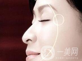 電波拉皮去除抬頭紋*果怎樣？