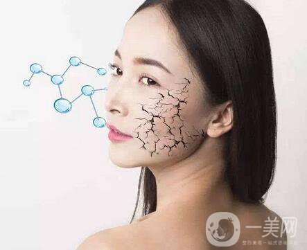 冰電波拉皮價(jià)格是多少？