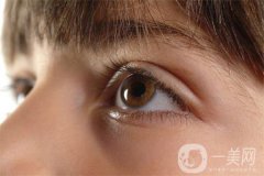 割雙眼皮術(shù)后護(hù)理注意事項(xiàng)有哪些