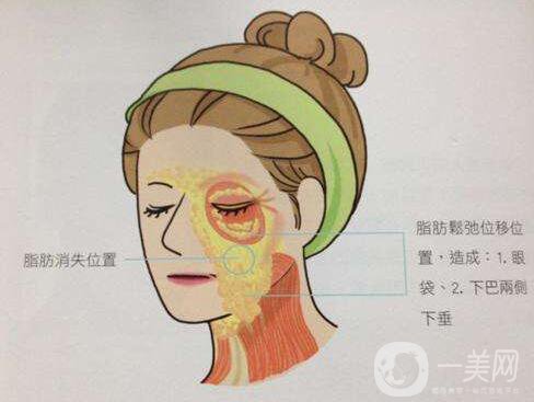 冰電波拉皮好嗎？冰電波拉皮優(yōu)勢(shì)！