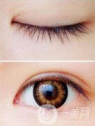開完眼角怎么預(yù)防增生？
