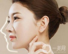 肋骨隆鼻多久可以修復(fù)？