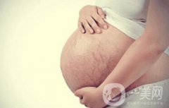 北京激光去妊娠紋價(jià)格一般是多少錢？