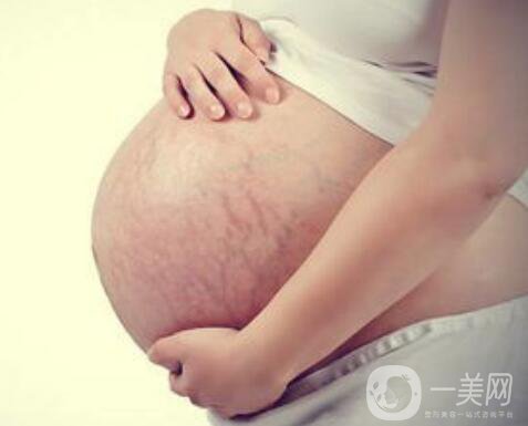 成都腹壁整形去妊娠紋多少錢(qián),腹壁整形去妊娠紋術(shù)后護(hù)理