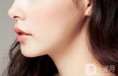 上海自體脂肪隆下巴費(fèi)用是多少?注意事項(xiàng)有哪些？
