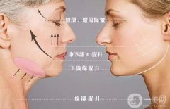 *的果到底如何呢?需要多少錢(qián)呢？