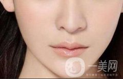 玻尿酸墊下巴會毀容嗎？注意事項有哪些？