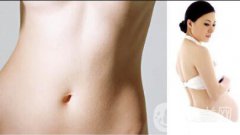 去妊娠紋方法有哪些？