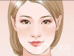 激光去曬斑會反彈嗎