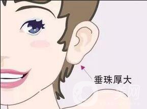 北京注射豐耳垂手術(shù)的價格一般是多少